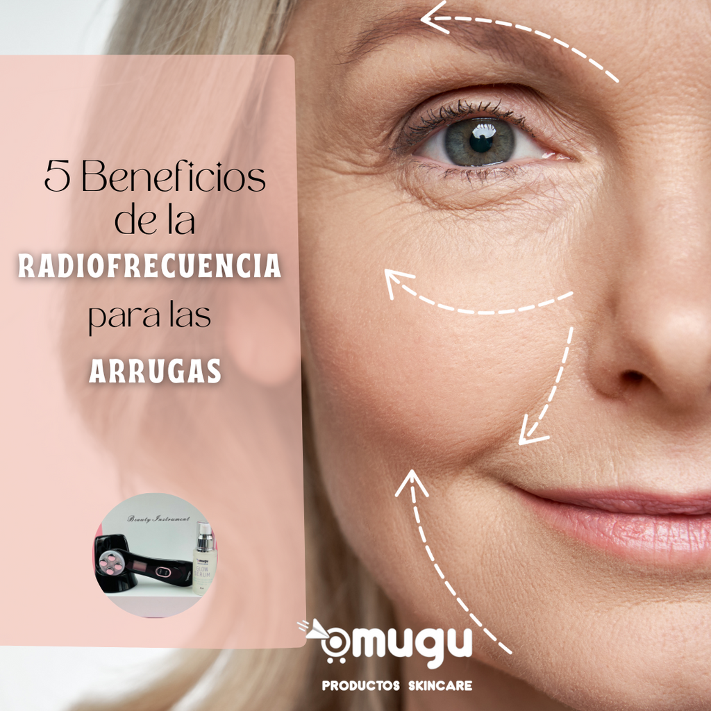 5 Beneficios de la Radiofrecuencia Facial