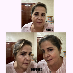 Kit de Levantamiento Facial y Reductor de Arrugas de Cuello y Rostro